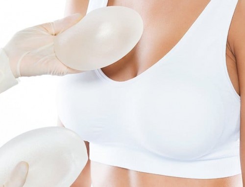 Breast Augmentation over 50