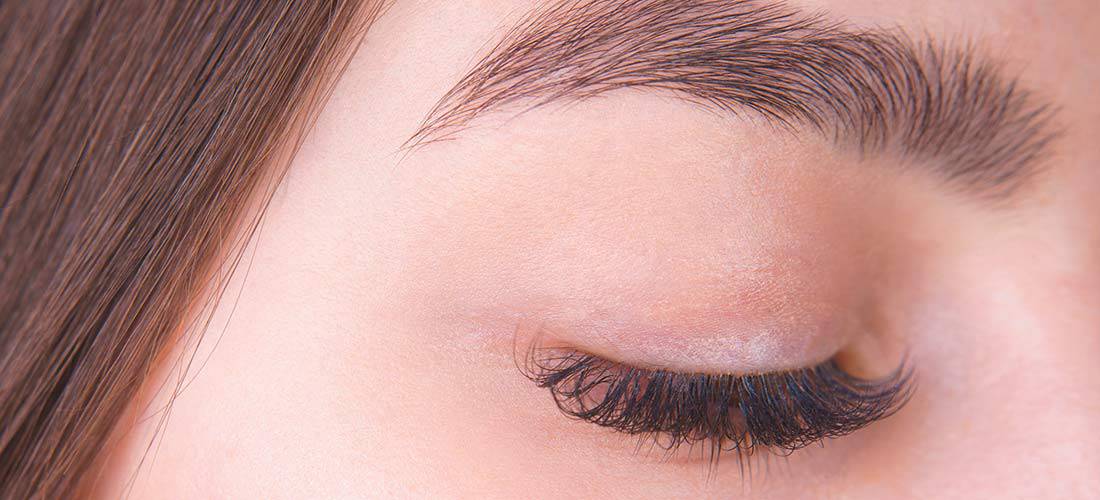 Brow Lift or Eyelid Surgery
