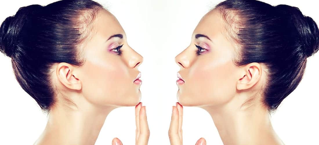 rhinoplasty nose job women's institute of cosmetic and Laser surgery